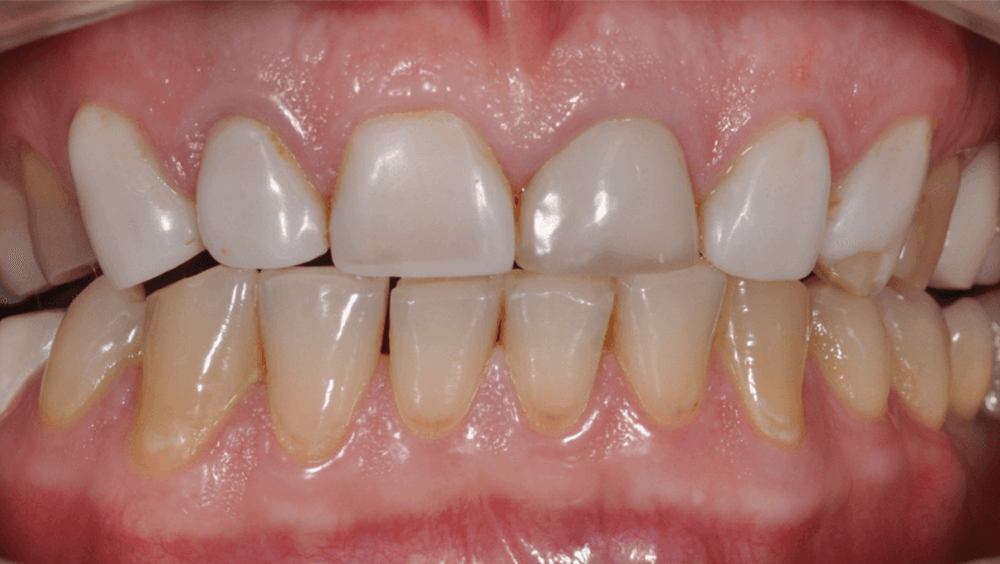 Cabinet Stomatologic Dentar Cluj Napoca Oral Design Clinic