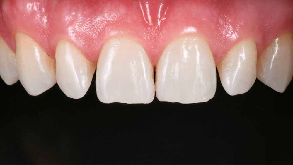 Cabinet Stomatologic Dentar Cluj Napoca Oral Design Clinic