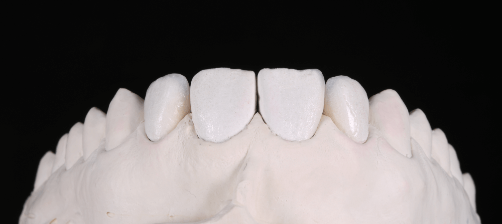 Cabinet Stomatologic Dentar Cluj Napoca Oral Design Clinic