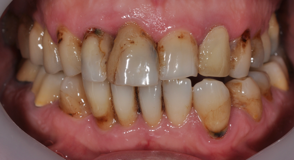 Cabinet Stomatologic Dentar Cluj Napoca Oral Design Clinic