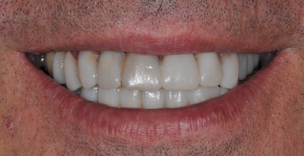 Cabinet Stomatologic Dentar Cluj Napoca Oral Design Clinic