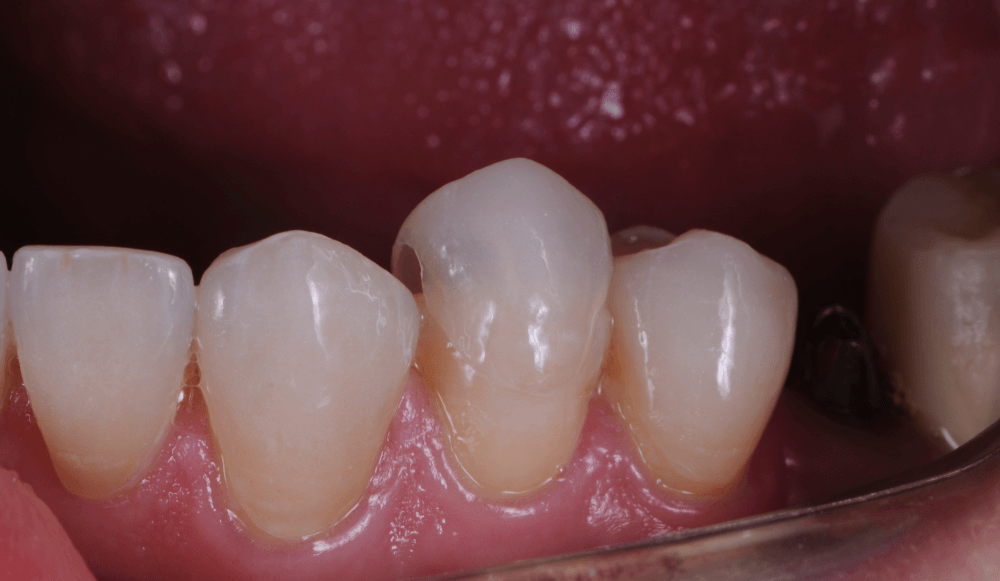 Cabinet Stomatologic Dentar Cluj Napoca Oral Design Clinic