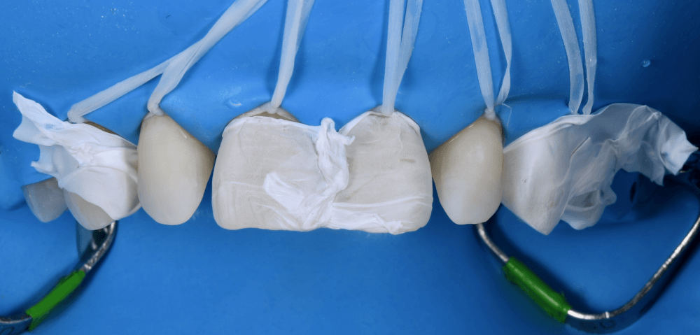 Cabinet Stomatologic Dentar Cluj Napoca Oral Design Clinic