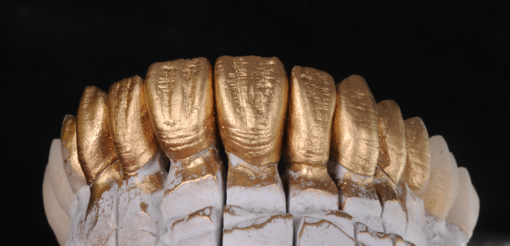 Cabinet Stomatologic Dentar Cluj Napoca Oral Design Clinic