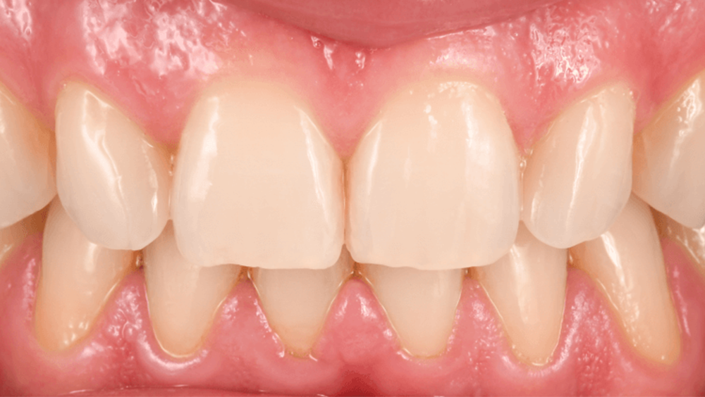 Cabinet Stomatologic Dentar Cluj Napoca Oral Design Clinic