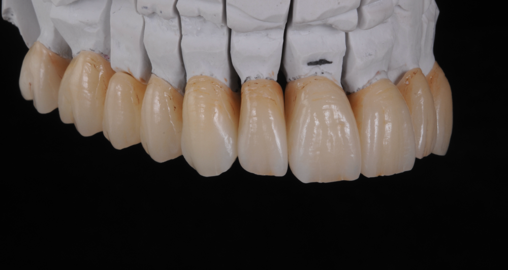 Cabinet Stomatologic Dentar Cluj Napoca Oral Design Clinic