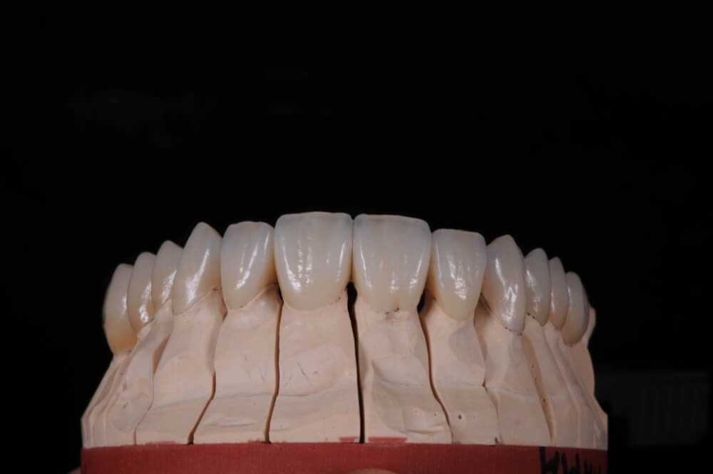 Cabinet Stomatologic Dentar Cluj Napoca Oral Design Clinic