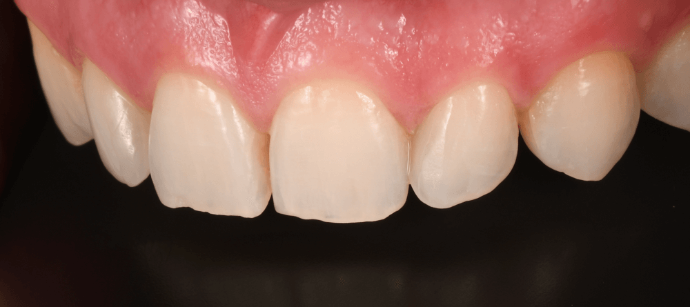 Cabinet Stomatologic Dentar Cluj Napoca Oral Design Clinic