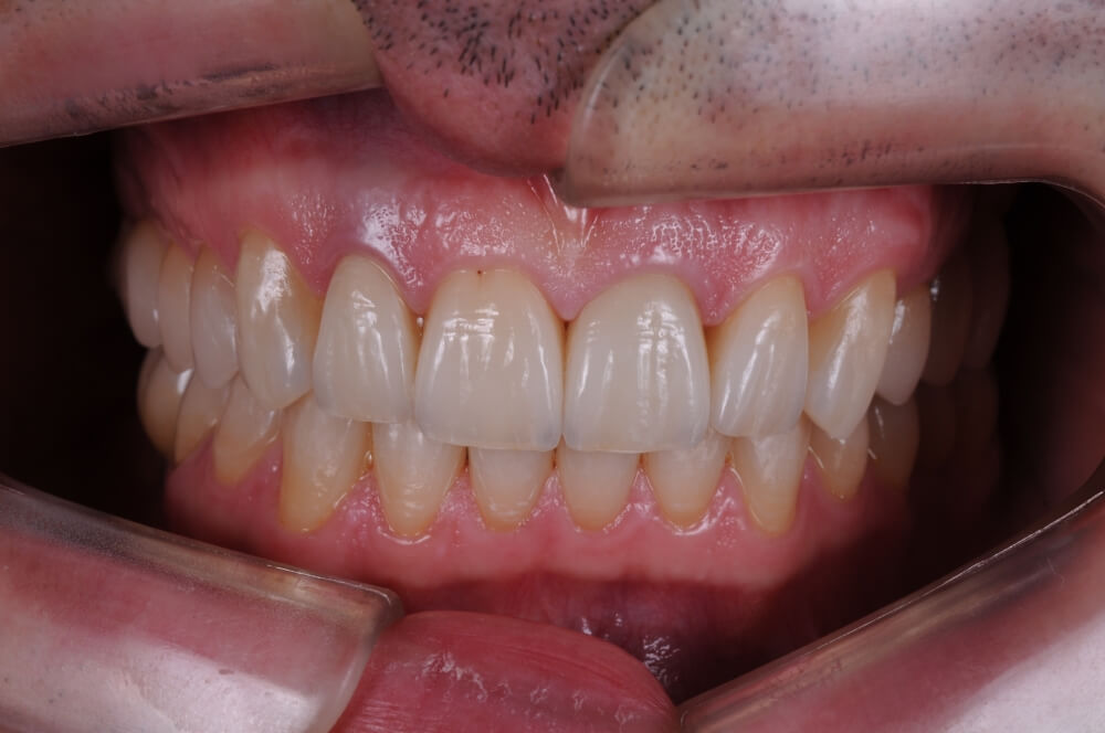 Cabinet Stomatologic Dentar Cluj Napoca Oral Design Clinic