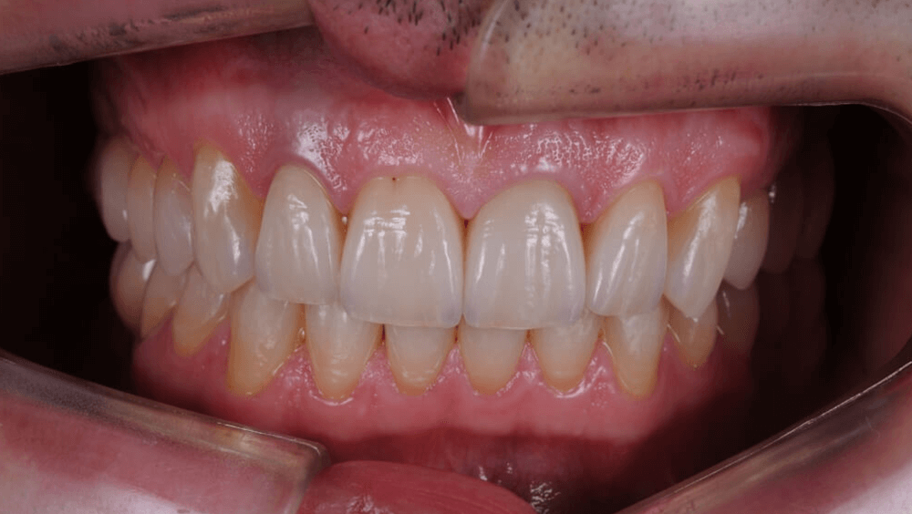 Cabinet Stomatologic Dentar Cluj Napoca Oral Design Clinic