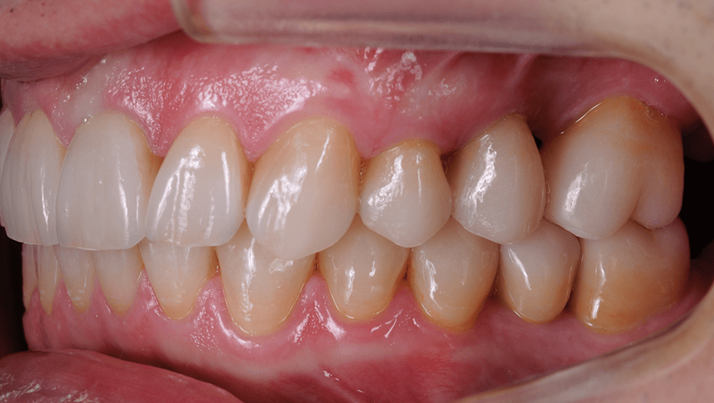 Cabinet Stomatologic Dentar Cluj Napoca Oral Design Clinic