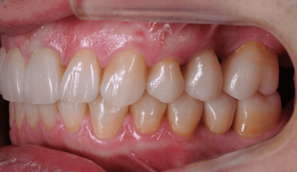 Cabinet Stomatologic Dentar Cluj Napoca Oral Design Clinic