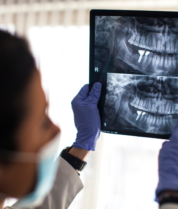 Radiografie panoramica dentara CT dinti Cabinet Stomatologic digital Dentar Cluj Napoca Oral Design Clinic