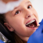 Stomatologie Pediatrică și Ortodonție pentru Copii și Adolescenți Aparat Dentar copii Cluj Napoca Manastur Oral Design Clinic