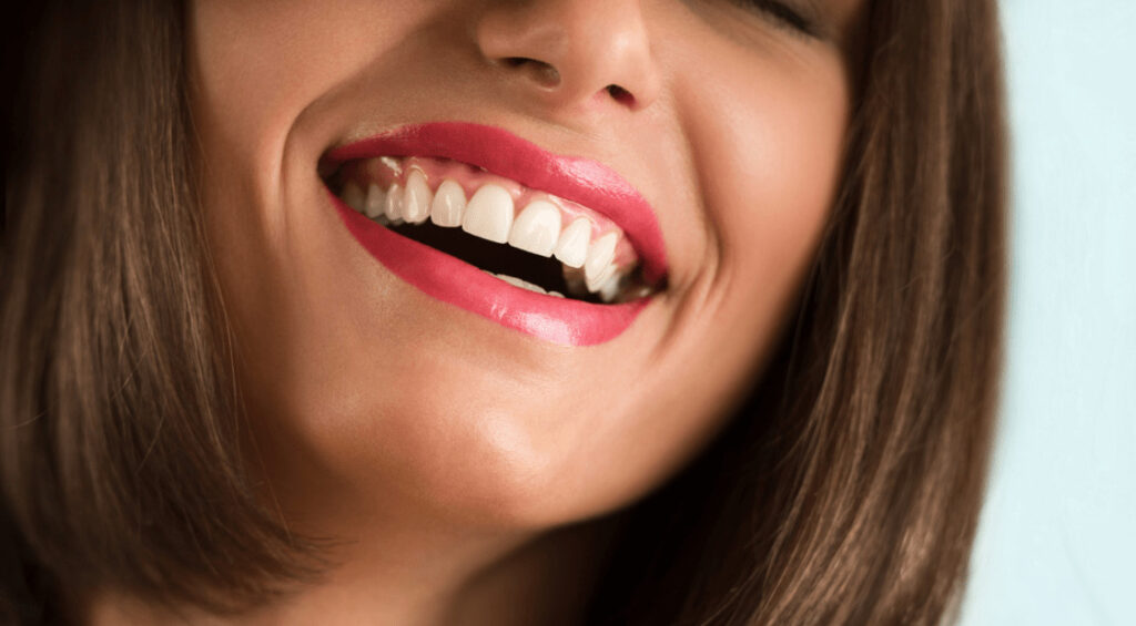 Descoperă avantajele fatetelor dentare pentru un zâmbet perfect. Corectează decolorarea, stricarea și spațiile între dinți cu această soluție populară.